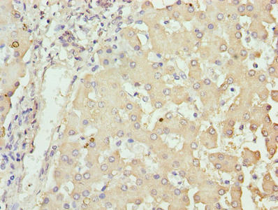 NUPL2 Antibody