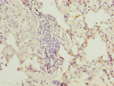 OGT Antibody