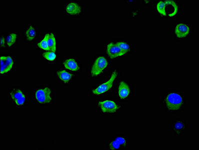 RPS27A Antibody