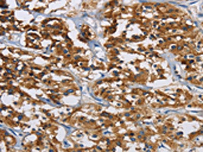 IGF2R Antibody