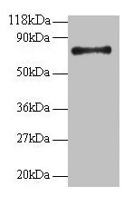 RPS18 Antibody