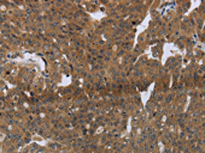 LAIR2 Antibody