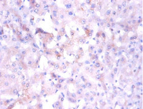 NDUFA1 Antibody
