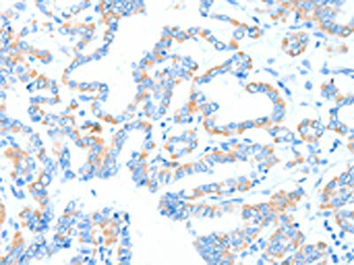 GPT Antibody