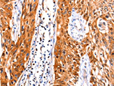 FBLN1 Antibody