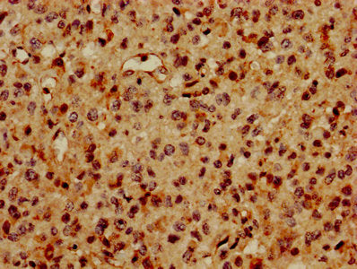 HIST1H2BC Antibody
