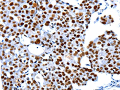 HDAC2 Antibody