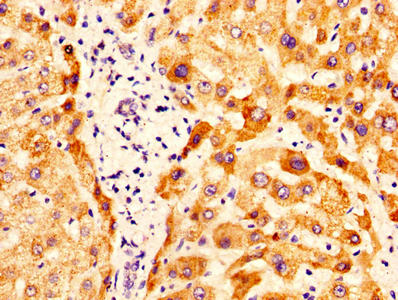OTC Antibody