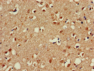 OTX1 Antibody