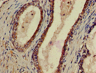 P2RX1 Antibody