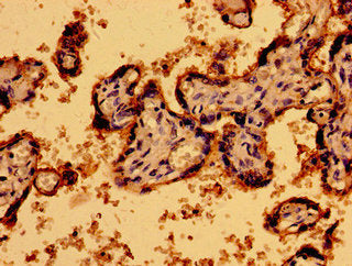 P2RY1 Antibody
