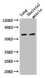 PAK3 Antibody