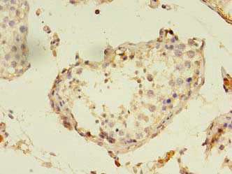 PANK1 Antibody