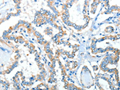 ADRA1A Antibody