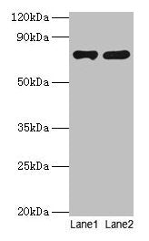 PARN Antibody
