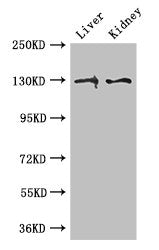PC Antibody