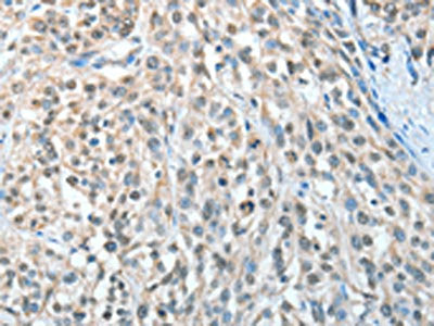 AGBL3 Antibody