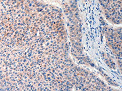 FAT4 Antibody