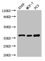 SLC9A3R2 Antibody