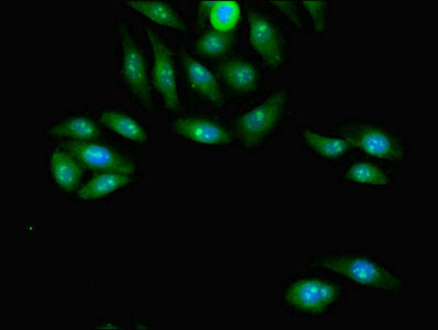 PCGF2 Antibody
