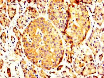 PCMT1 Antibody