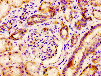 PCSK6 Antibody