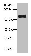 Pdia2 Antibody