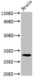 Pdxp Antibody