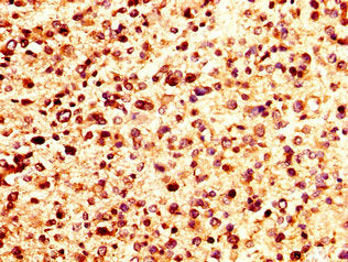 PF4 Antibody