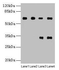 PGM1 Antibody