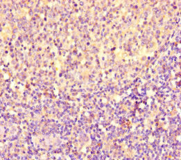 PGP Antibody