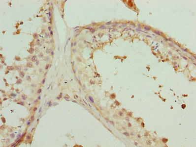 PHF13 Antibody
