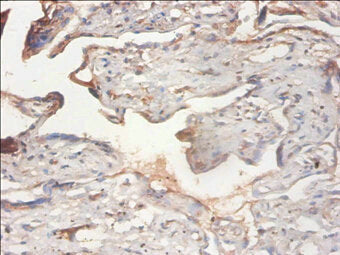 PHF5A Antibody