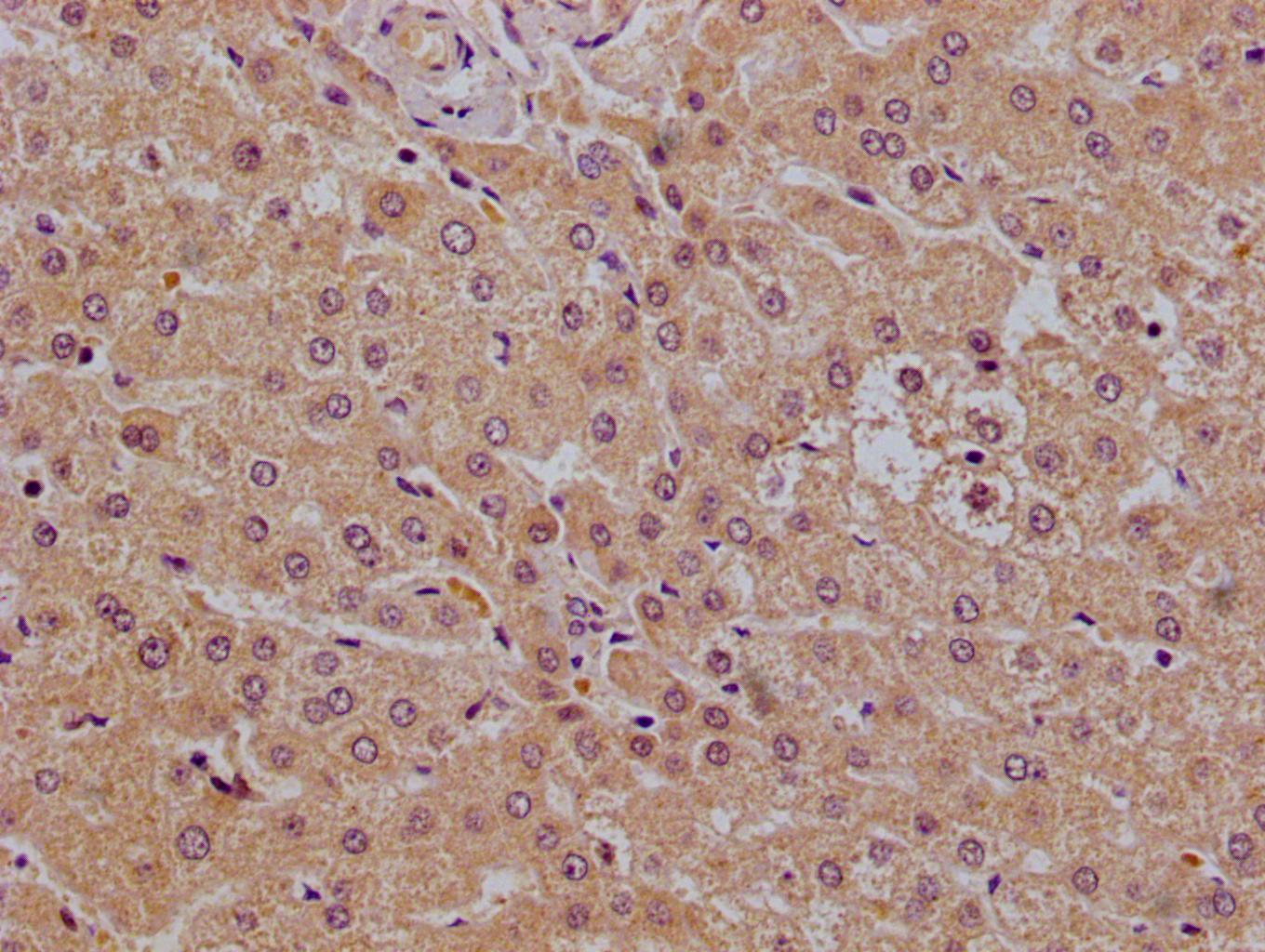 PHLDA3 Antibody