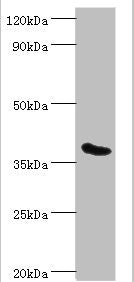 PHYH Antibody