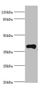 PHYH Antibody