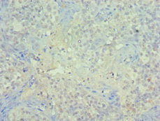 PIAS1 Antibody