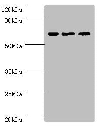PIAS2 Antibody