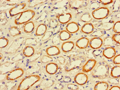 PIGP Antibody