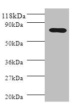 PIGR Antibody