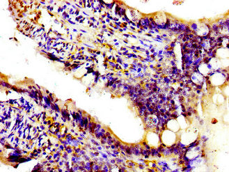 PIK3CA Antibody