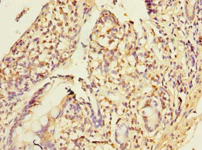 PLA2G16 Antibody