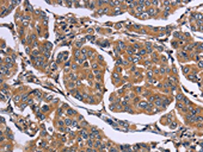 EGR4 Antibody