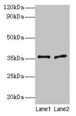 Plaur Antibody