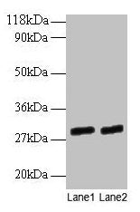 GATD3A Antibody