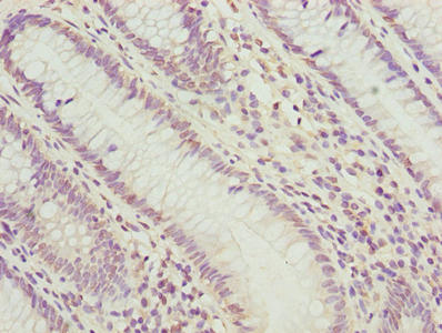 PLK1 Antibody