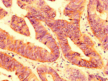 PLXNB1 Antibody