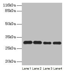 PMM1 Antibody