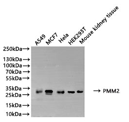 PMM2 Antibody