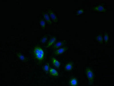 PMP22 Antibody